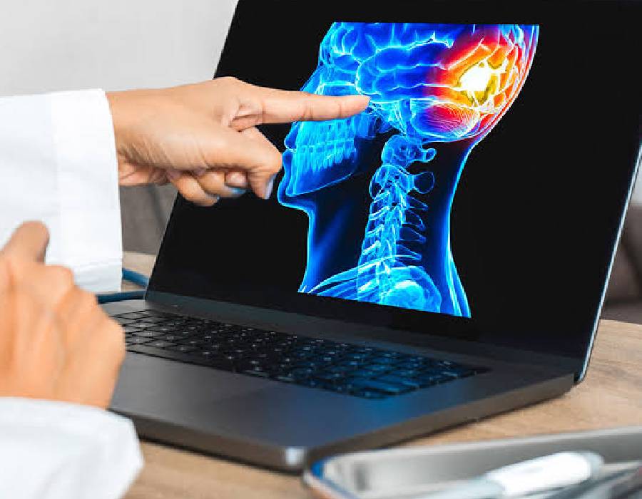 Memory and Neuro Health service at Health Pilot Care